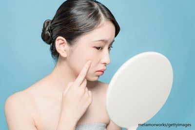 肌を気にする女性