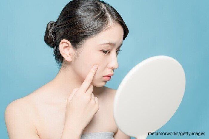 ニキビだと思って放置したら…生まれて初めて顔にメスを入れた話