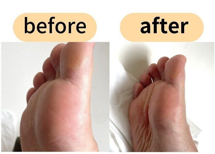 サンダルの季節到来！DAISOのフットマスクパックでツヤ足に
