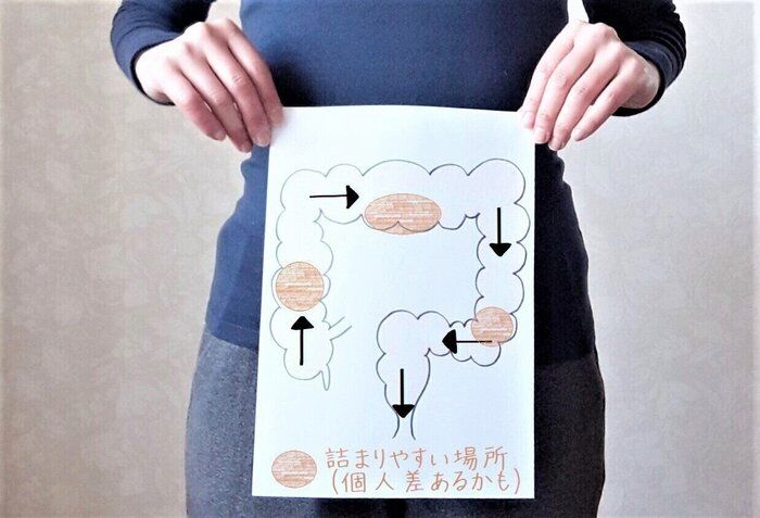 週イチだった頑固な便秘を劇的に改善した3つの習慣とは