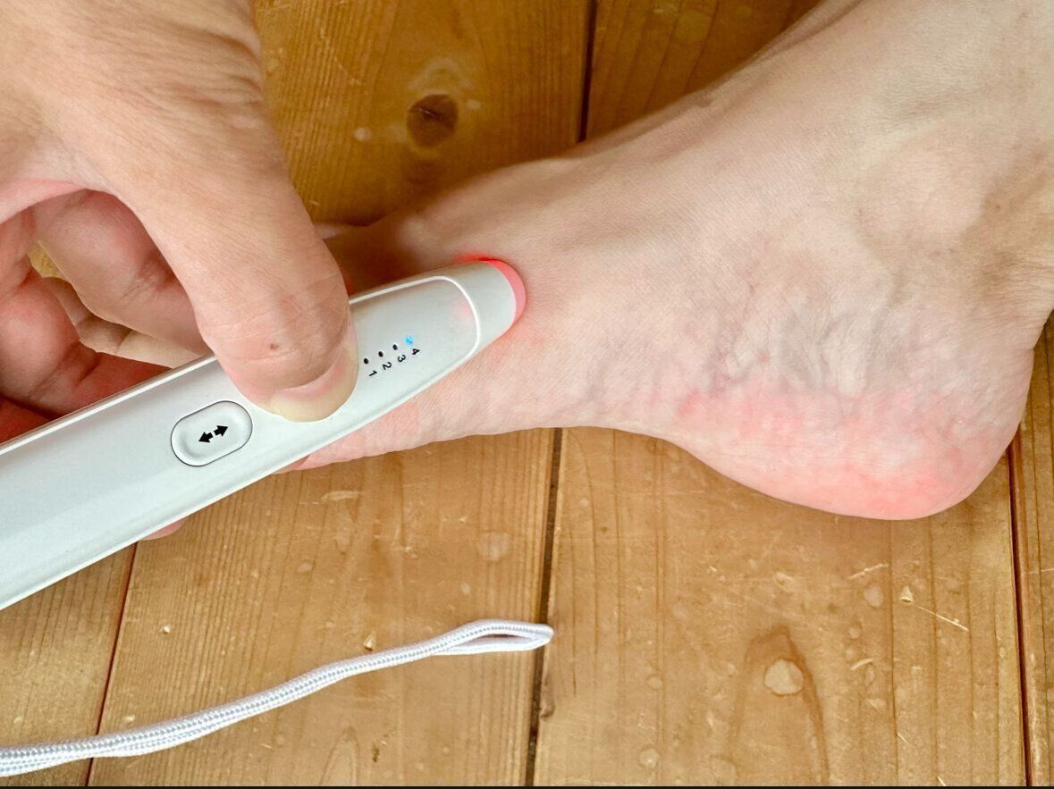 【蚊の季節】温めてかゆみを消す⁉︎話題の治療がすごかった