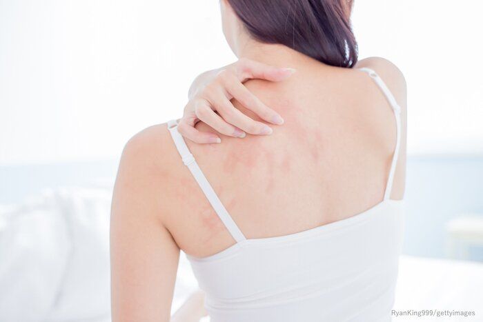 外出が少ない人には〇〇アレルギーのリスク⁉用心すべきこの時期の大敵とは？