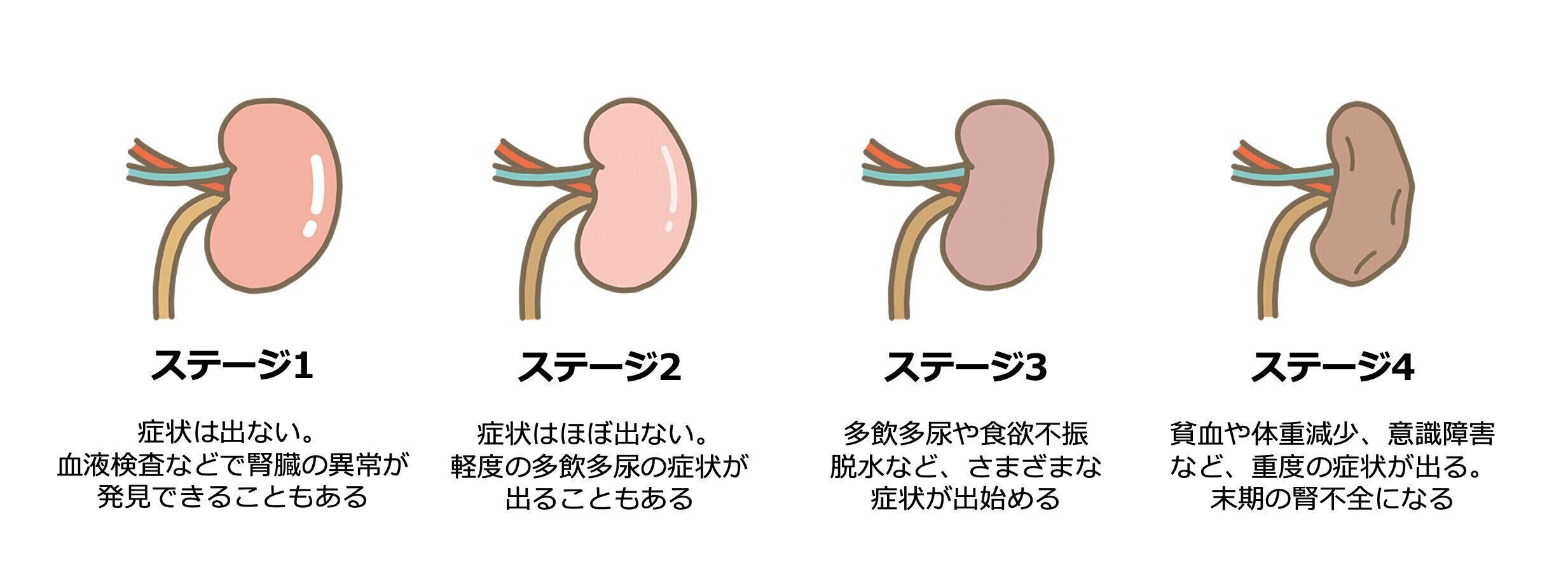 腎臓病のステージを開設したイラスト