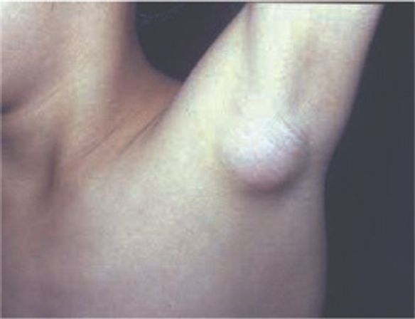 獣医師監修 猫の 噛む ひっかく 防止策は 対処法や応急処置も ねこのきもちweb Magazine 獣医師監修 猫の 噛む ひっかく 防止策は 対処法や応急処置も ねこのきもちweb Magazine