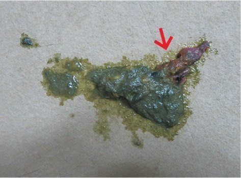 異物が混ざっている吐しゃ物