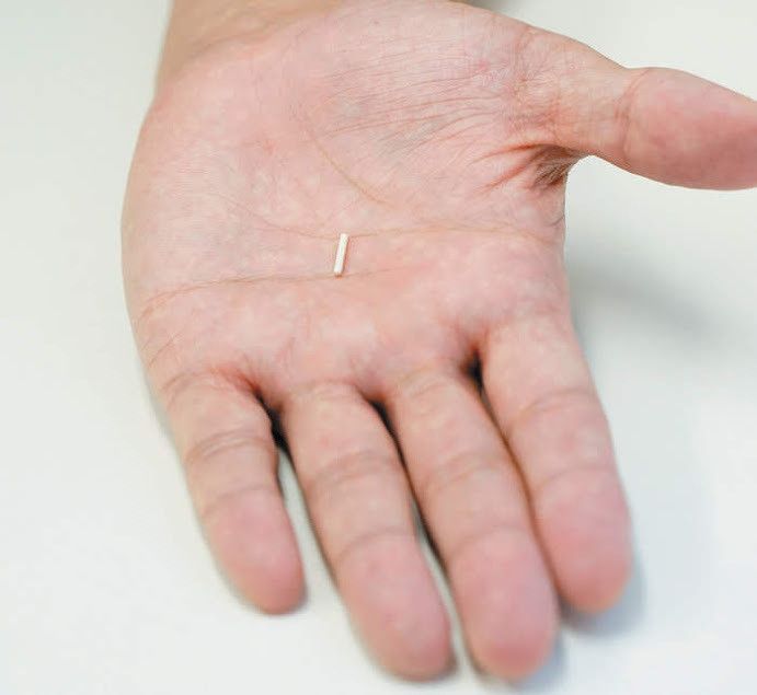 マイクロチップの大きさ