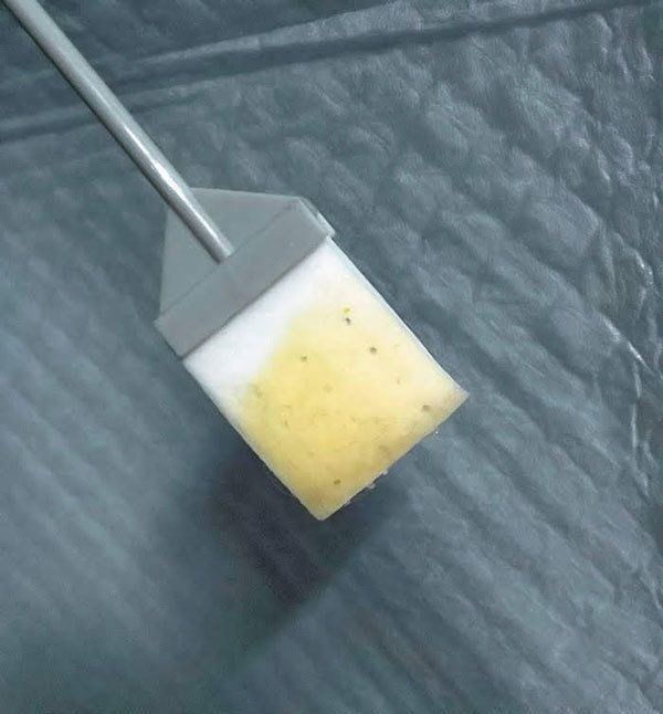 ウロキャッチャー