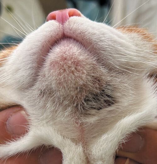 こんなあごニキビには注意