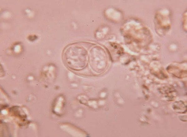 トキソプラズマ症