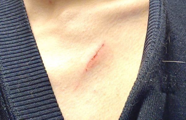 傷ができた飼い主さん