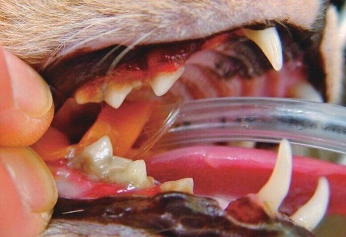 中程度の歯周病の症例