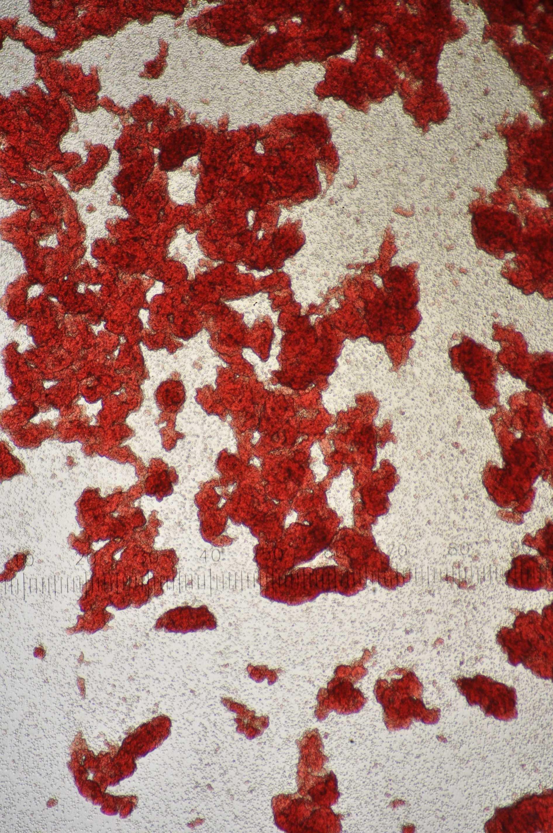 赤血球同士がくっついてしまった状態の血（症例写真提供／東京動物医療センター）