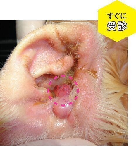 耳の中のできもの