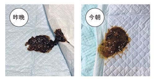 経過がわかるように撮影を