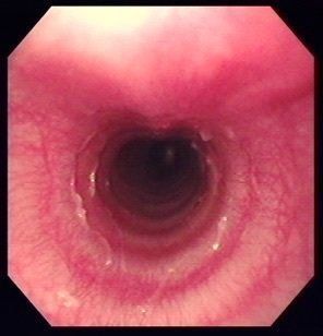 症例写真提供／アトム動物病院動物呼吸器病センター