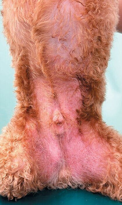 脂漏症の症例写真