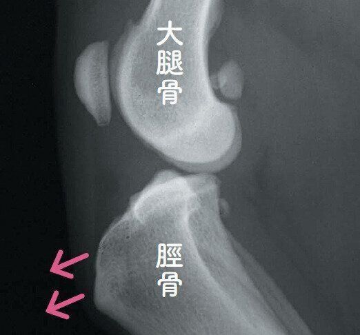 前十字靭帯断裂のレントゲン写真