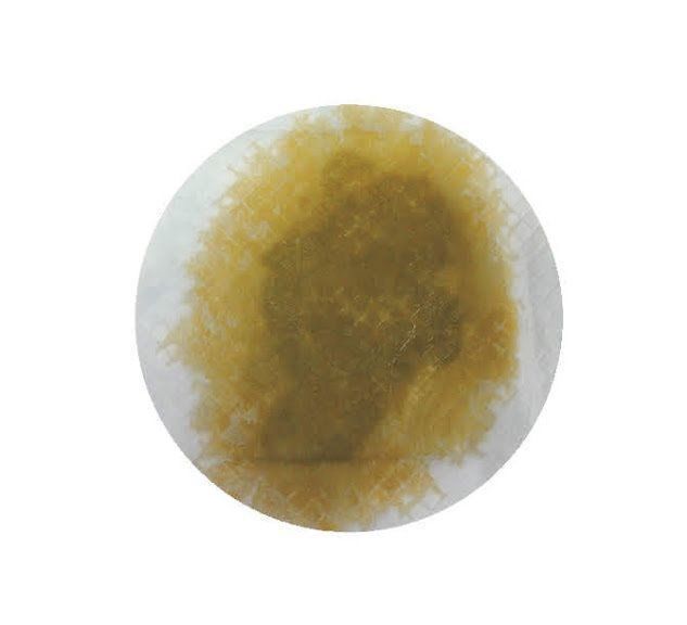 危険なオシッコ・緑色