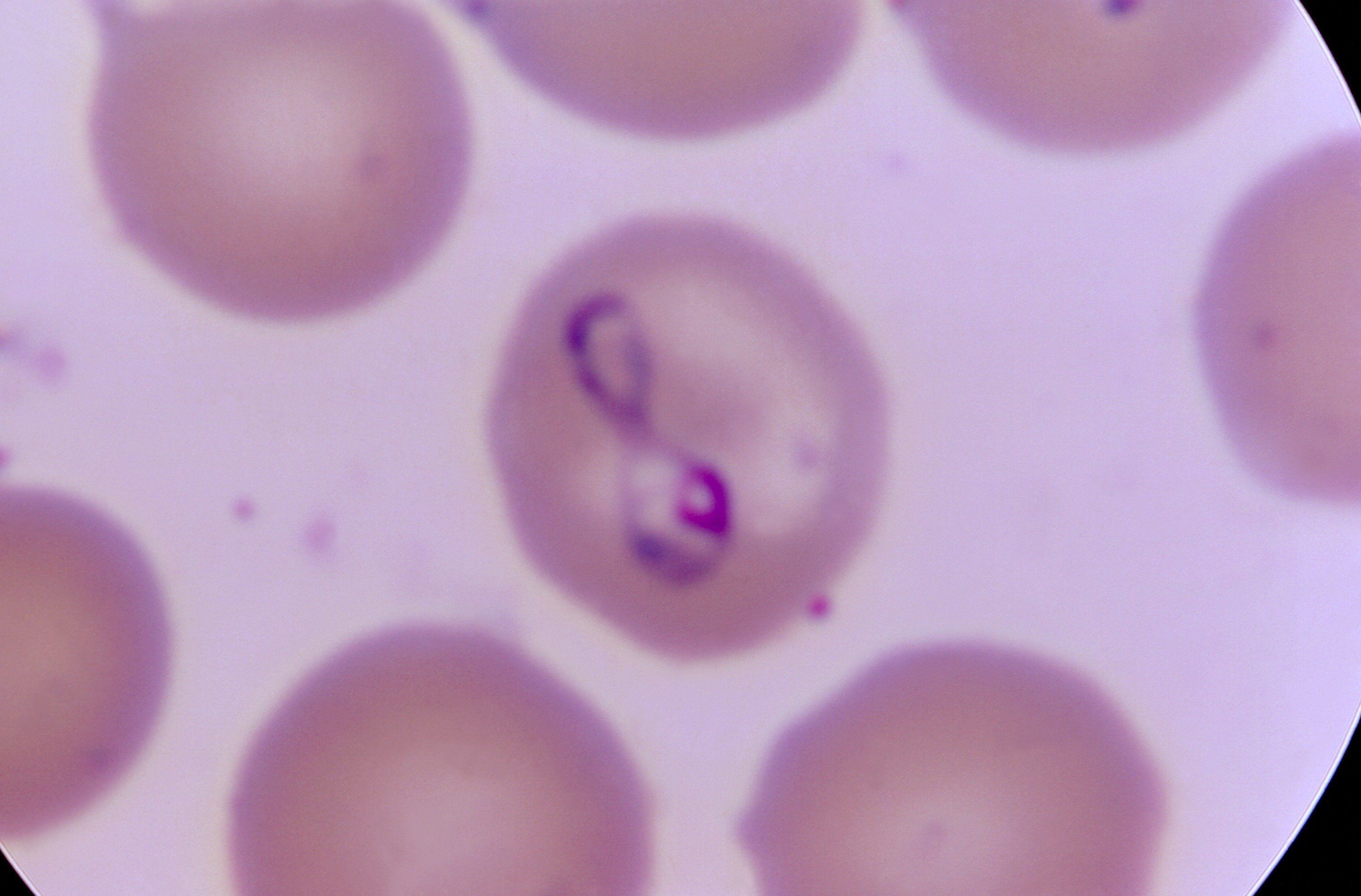 人の赤血球に寄生しているバベシアの顕微鏡写真（photo by CDC's public Health Image Library）