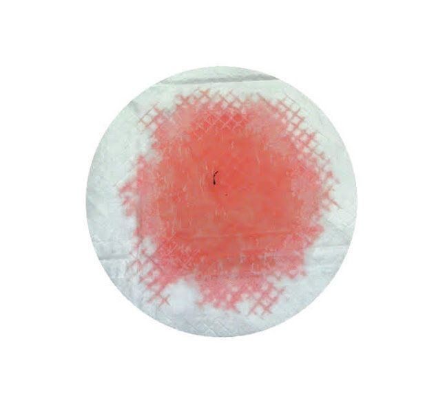 危険なオシッコ・全体的に赤い