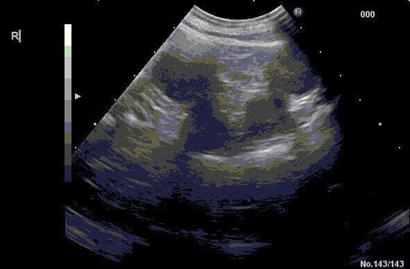 子宮蓄膿症のエコー写真