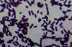 病原体であるコリネバクテリウム属菌（写真提供／斉藤動物病院院長　齊藤邦史先生）