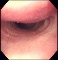 症例写真提供／アトム動物病院動物呼吸器病センター