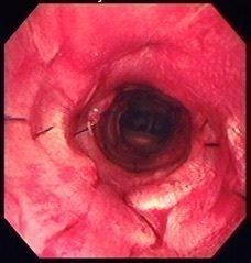 症例写真提供／アトム動物病院動物呼吸器病センター