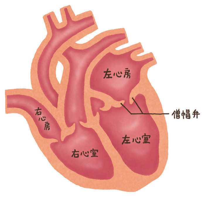 「僧帽弁閉鎖不全症（そうぼうべんへいさふぜんしょう）」