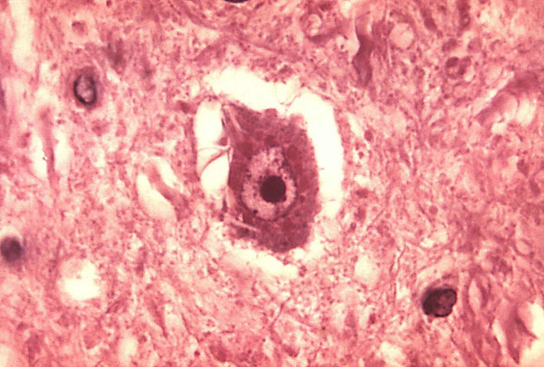 すべての哺乳類に感染する（写真提供：CDC's Public Health Image Library）