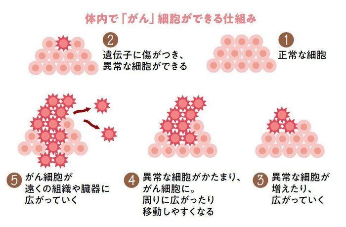 「がん」細胞がつくられていく仕組み