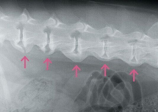変形性脊椎症のレントゲン写真