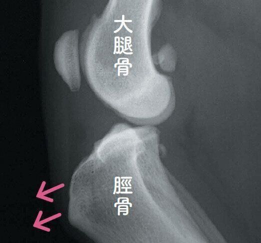 前十字靭帯断裂のレントゲン写真
