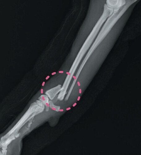 撓尺骨骨折のレントゲン写真