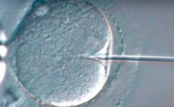 元気がよく、正常な形の精子を選ぶため、顕微鏡で1000倍以上に拡大して判別。