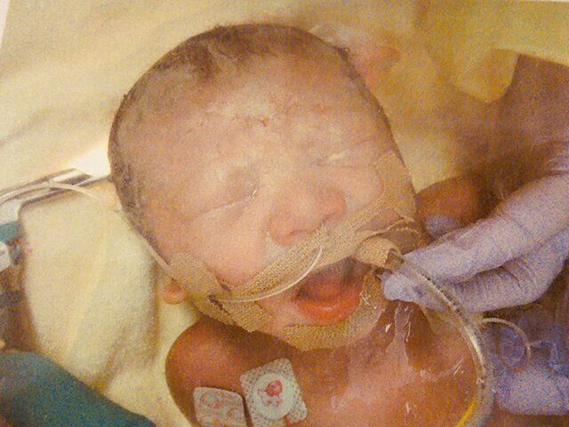 医療的ケア児育児・出産体験談 仲谷さやかさんインタビュー