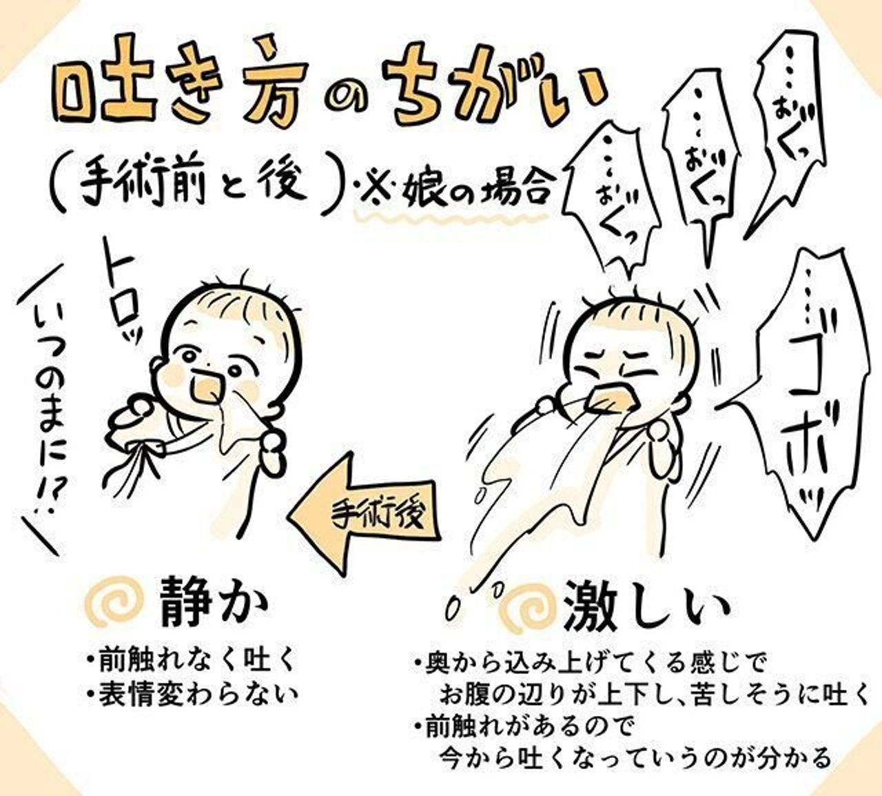 生後12日から噴水のようにミルクを吐き続ける娘 飲ませ方が悪いの 悩む日々に告げられた病名とは たまひよ 生後12日から噴水のようにミルクを吐き続ける娘 飲ませ方が悪いの 悩む日々に告げられた病名とは たまひよ