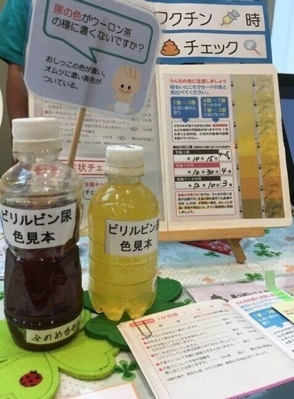 救急車の中で心臓が止まりそうに 胆道閉鎖症でわが子をなくしたママ おしっことうんちの色で早期発見を たまひよ 救急車の中で心臓が止まりそうに 胆道閉鎖症でわが子をなくしたママ おしっことうんちの色で早期発見を たまひよ