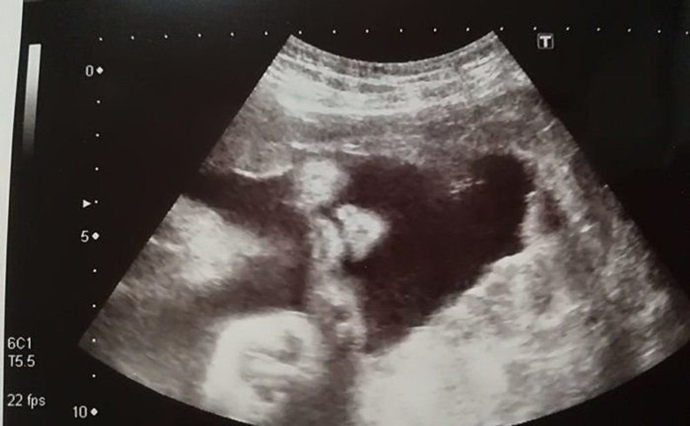 妊娠30週 赤ちゃんのエコー写真 超音波写真まとめ たまひよ