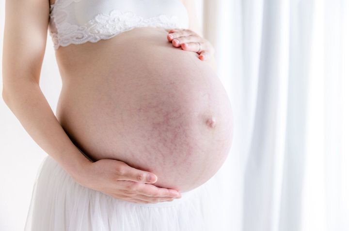 できればできてほしくない妊娠線 妊娠線ができる人 できない人 専門家 たまひよ できればできてほしくない妊娠線 妊娠線ができる人 できない人 専門家 たまひよ