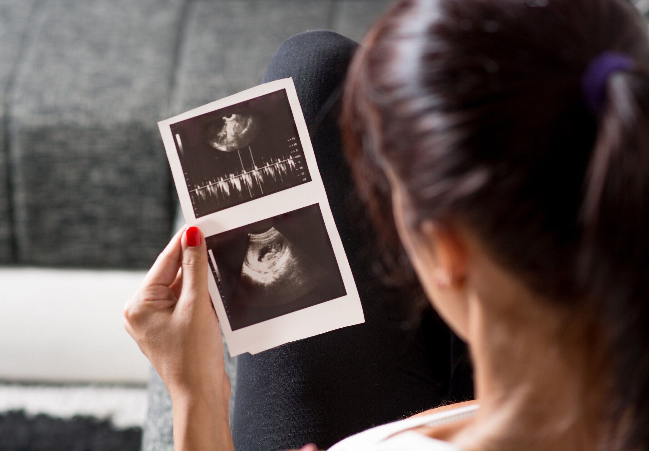 妊娠中の女性）