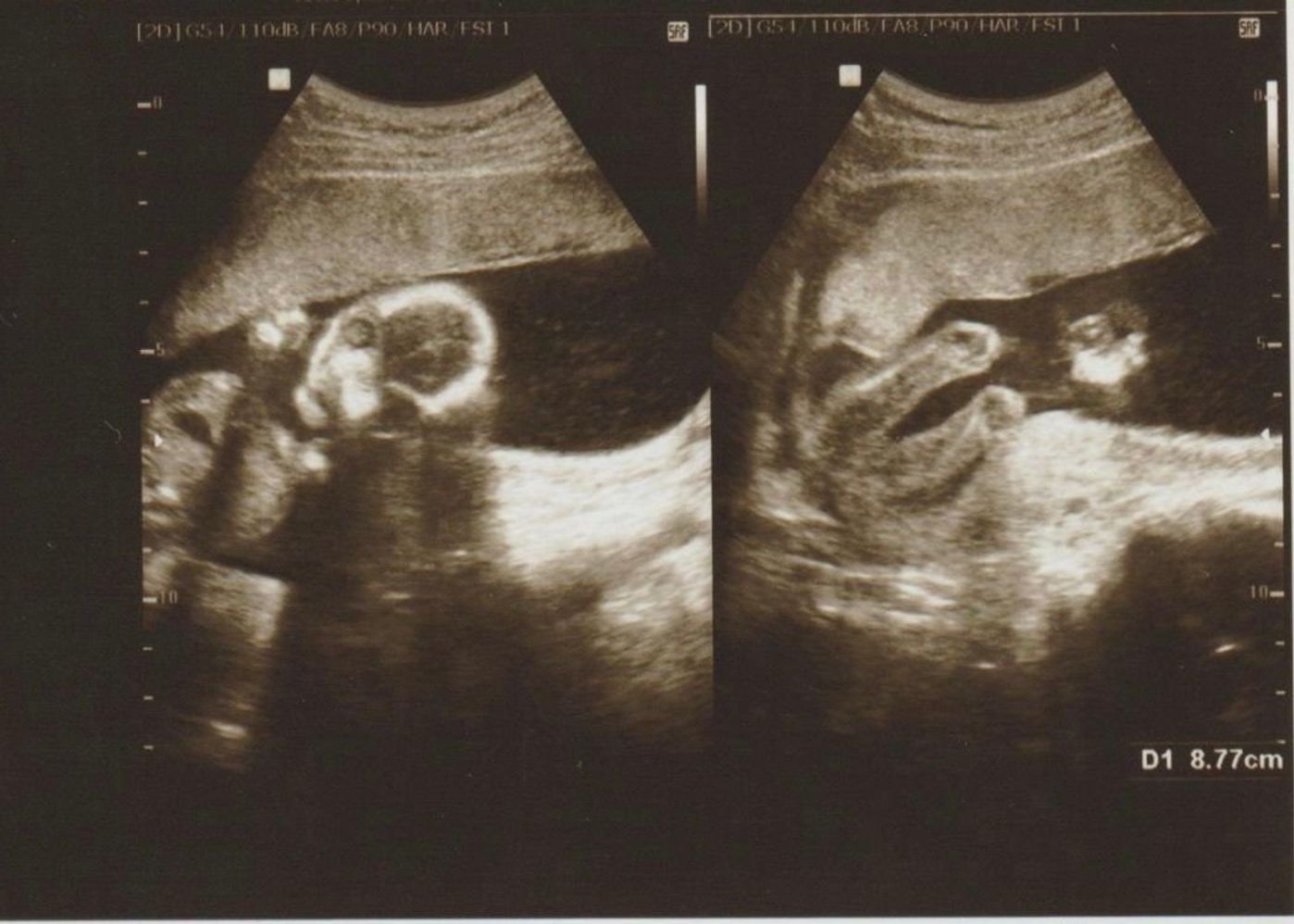 待望の妊娠判明 エコー写真に見る 我が子を胸に抱くまでの 命の軌跡275日 たまひよ 待望の妊娠判明 エコー写真に見る 我が子を胸に抱くまでの 命の軌跡275日 たまひよ