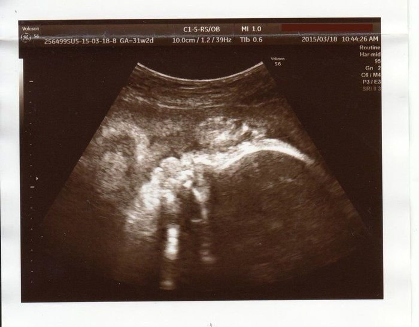 妊娠31週 赤ちゃんのエコー写真 超音波写真まとめ たまひよ 妊娠31週 赤ちゃんのエコー写真 超音波写真まとめ たまひよ