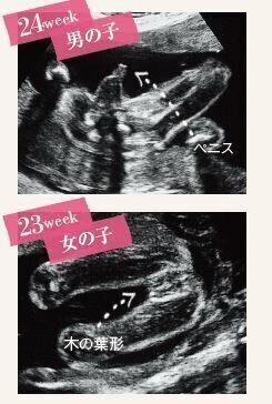 妊娠24週男の子と妊娠23週女の子の超音波写真・エコー写真