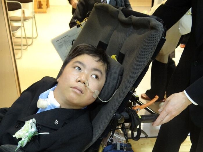 X連鎖副腎白質ジストロフィーの合併症