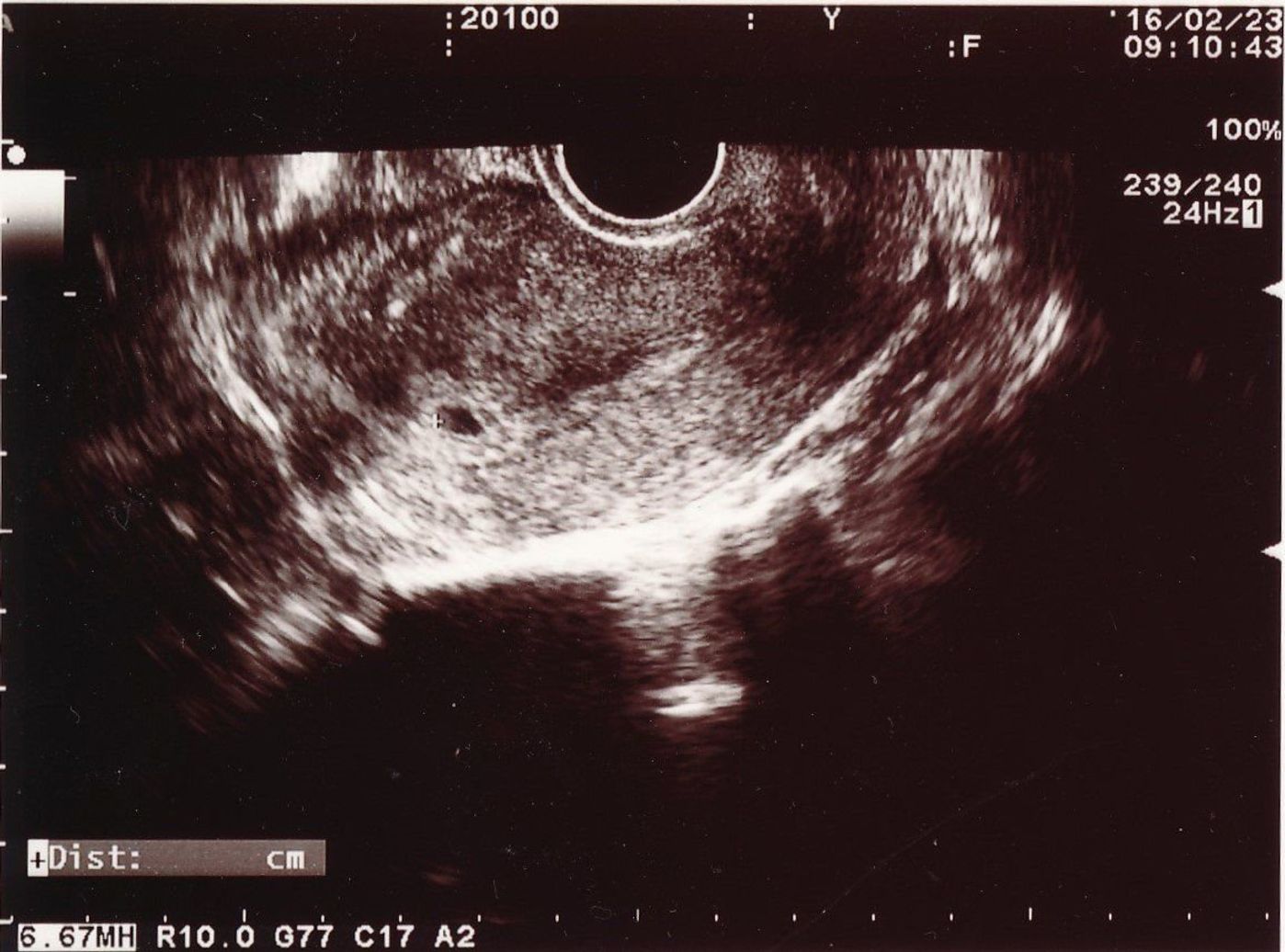 思いがけず授かった2人目は43歳の高齢出産 健診は不安と期待との板挟み たまひよ 思いがけず授かった2人目は43歳の高齢出産 健診は不安と期待との板挟み たまひよ