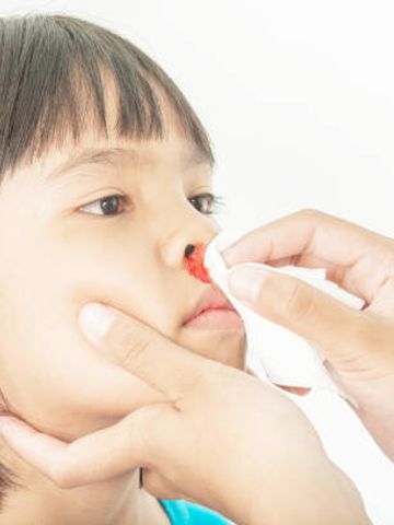 3日連日の子どもの鼻血 血液の病気かもと心配する母親に 小児科医が解説 たまひよ