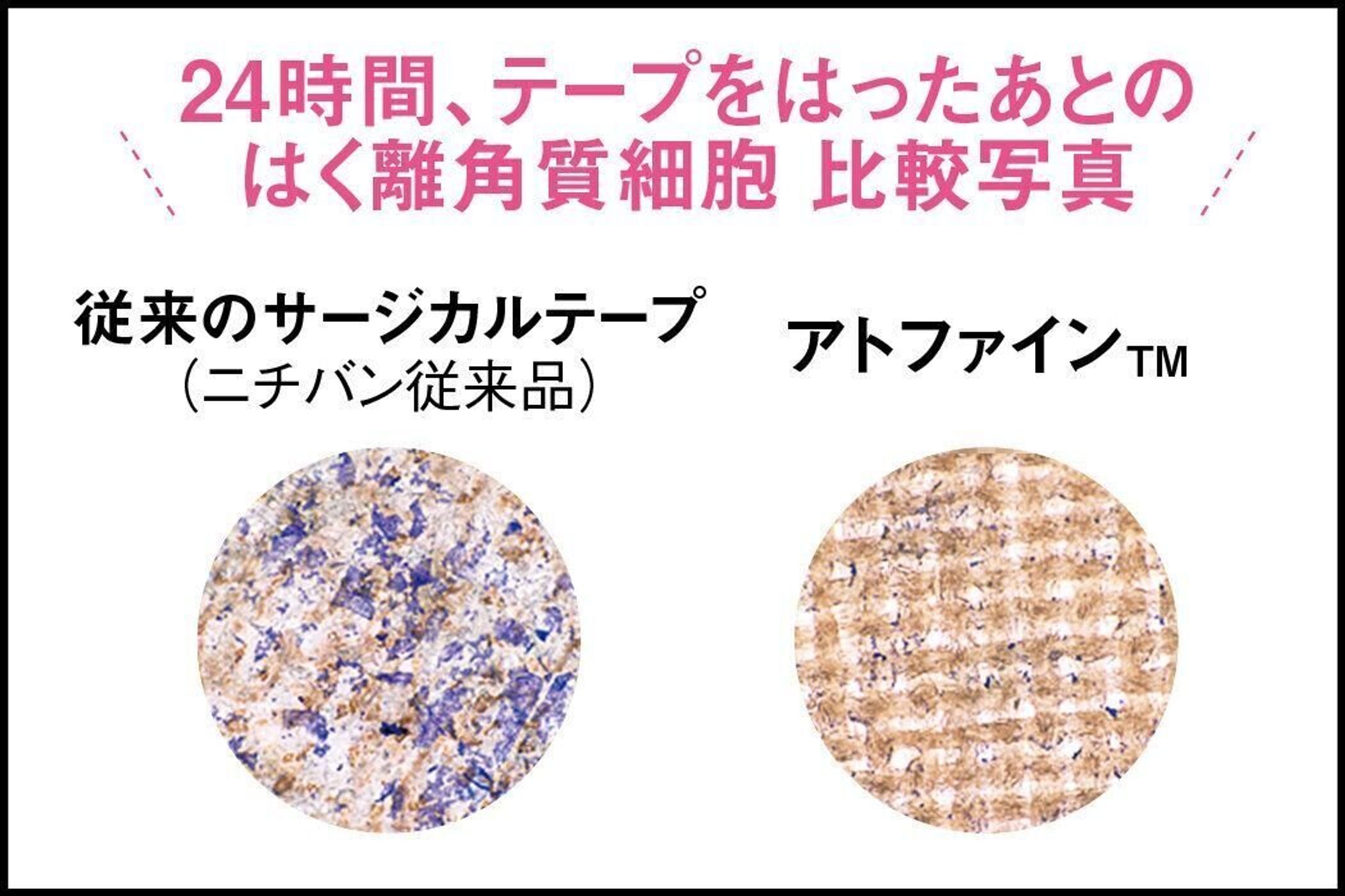 産後が快適に だれでもなる可能性がある 帝王切開 傷あとケアにはコレ たまひよ 産後が快適に だれでもなる可能性がある 帝王切開 傷あとケアにはコレ たまひよ