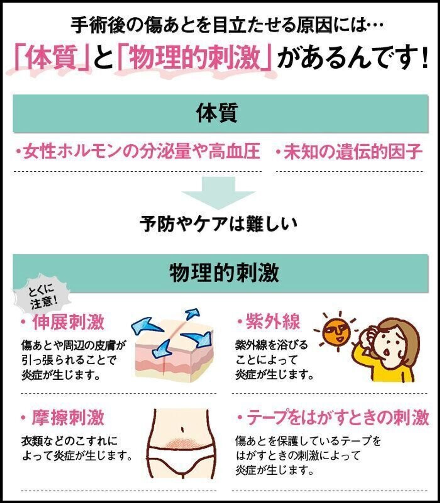 帝王切開の傷あとを目立たせる 2つの原因 って だれでもなる可能性がある 帝王切開 傷あとケアの方法 たまひよ 帝王切開の傷あとを目立たせる 2つの原因 って だれでもなる可能性がある 帝王切開 傷あとケアの方法 たまひよ