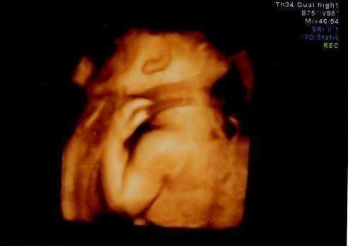 妊娠29週 赤ちゃんのエコー写真 超音波写真まとめ たまひよ